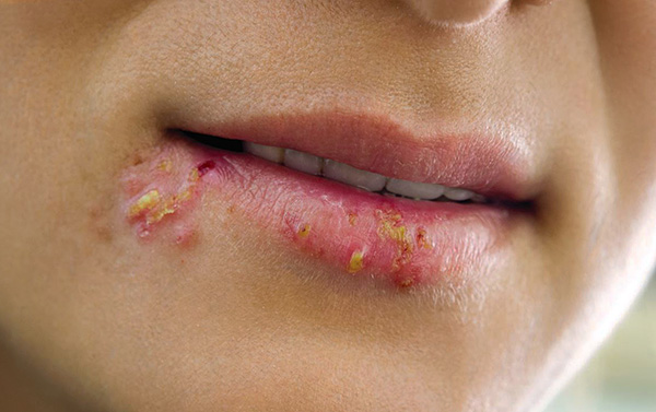 Важно понимать основные правила лечения, и тогда при выборе препарата можно избежать серьезных ошибок. Важно понимать основные правила лечения, и тогда при выборе препарата можно избежать серьезных ошибок.