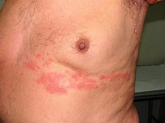 Пример заболевания Пример заболевания