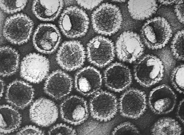 Частицы вируса HSV-1 под микроскопом Частицы вируса HSV-1 под микроскопом