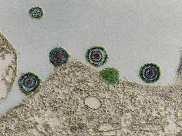 Вирусные частицы атакуют оболочку клетки... Вирусные частицы атакуют оболочку клетки...